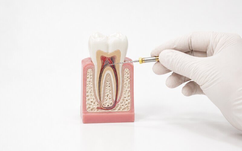 Endodontics