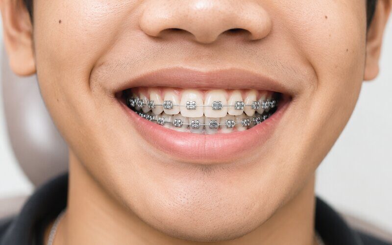 Orthodontics