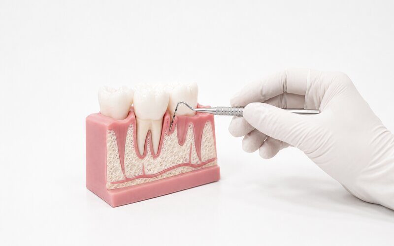 Periodontics